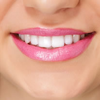 Strahlendes Lächeln mit Zahnimplantaten
